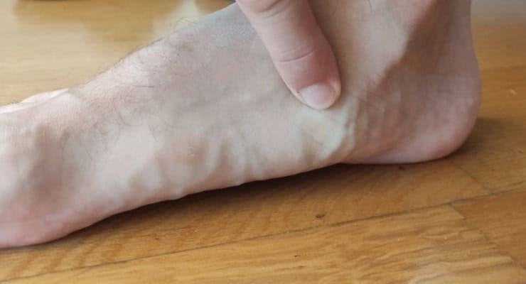 rare foot structure