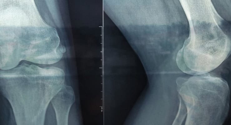 X-ray examination