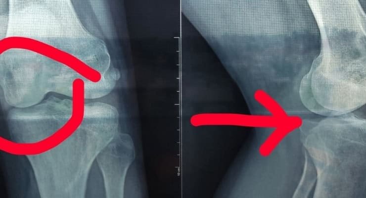 X-ray picture