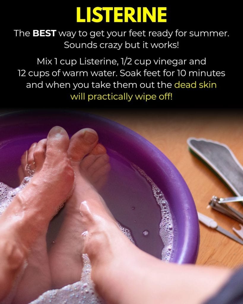 Listerine Foot Soak Recipe