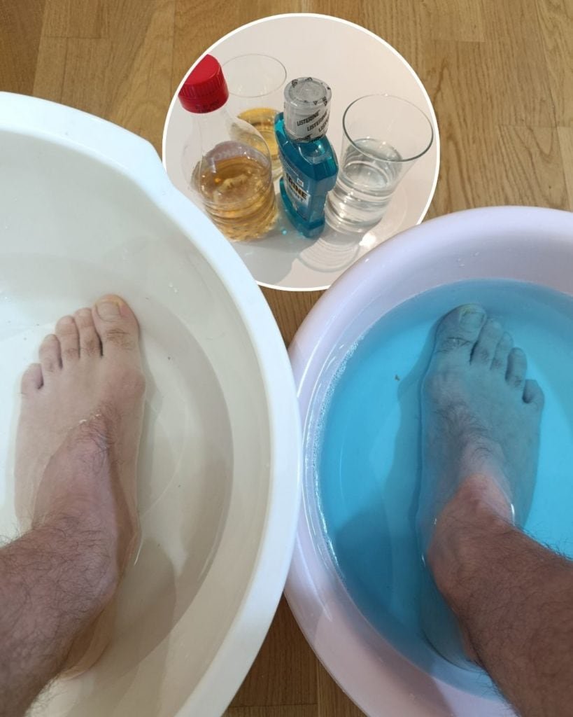 Personal experience: Listerin Vs ACV