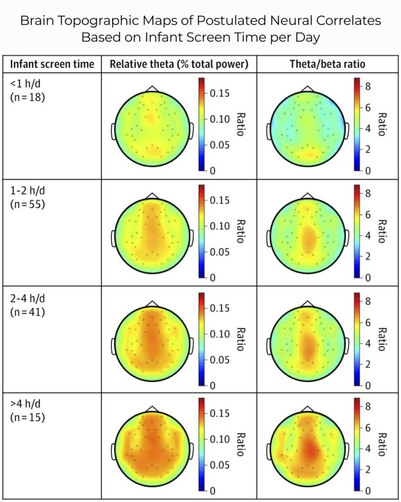  Brain Topographic Maps of Postulated Neural Correlates Based on Infant Screen Time per Day