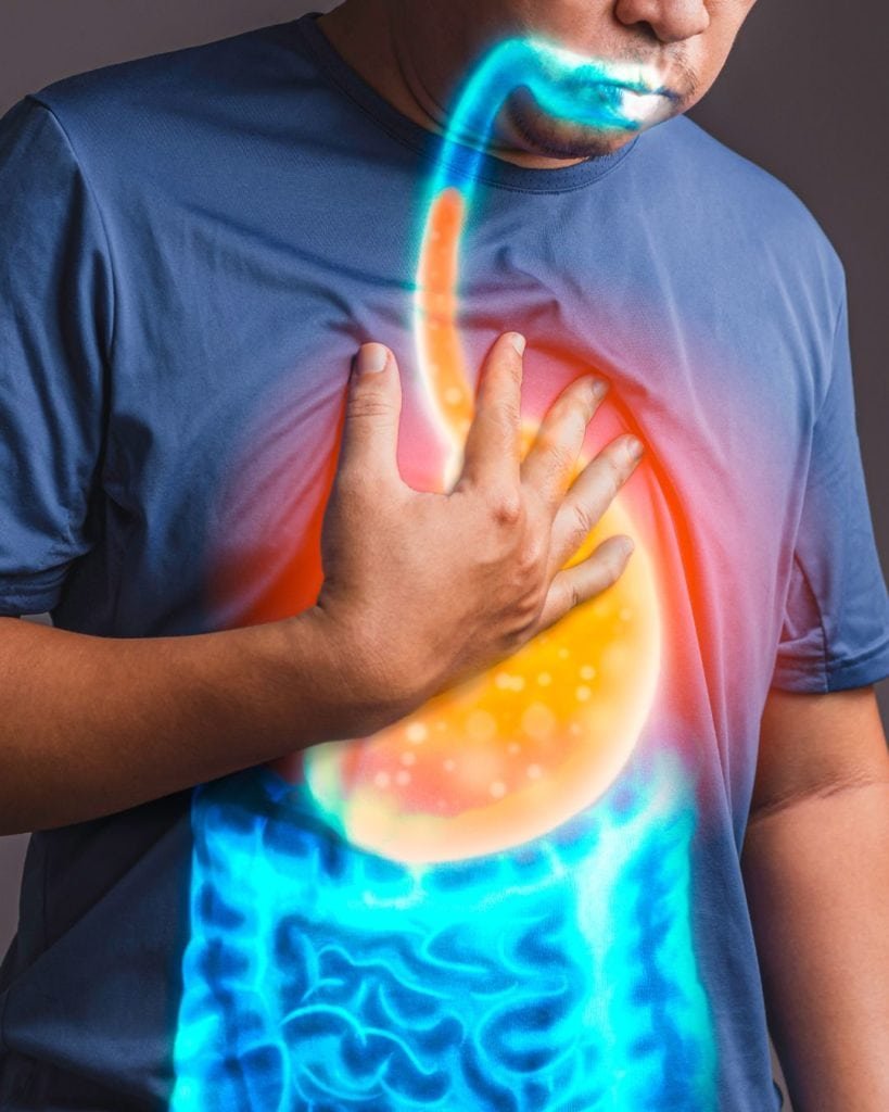 People With Acid Reflux Or GERD