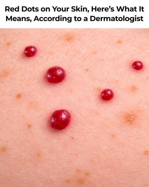 red dots