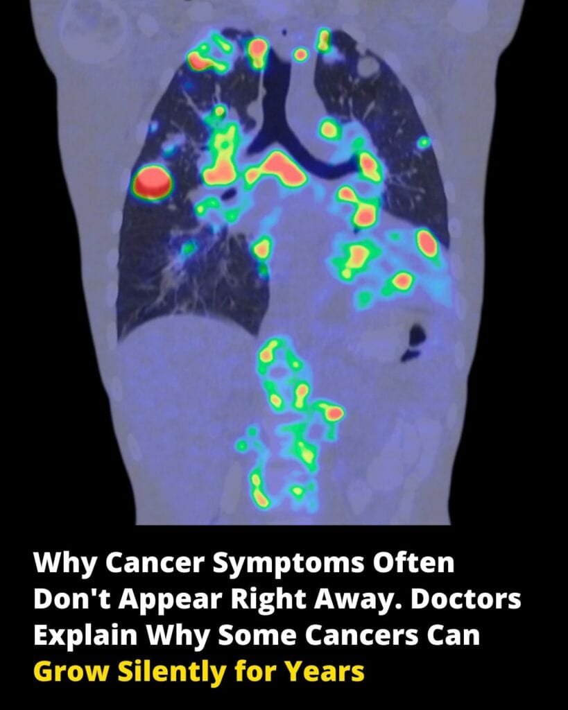 cancer symptoms after 10-15 years